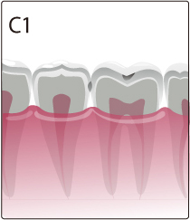 c1