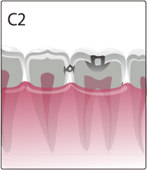 c2