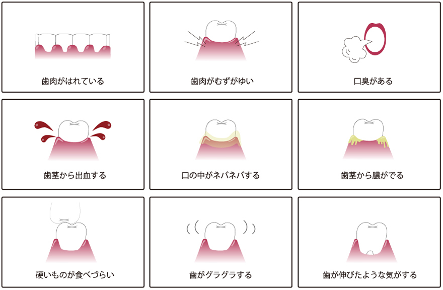 歯周病について